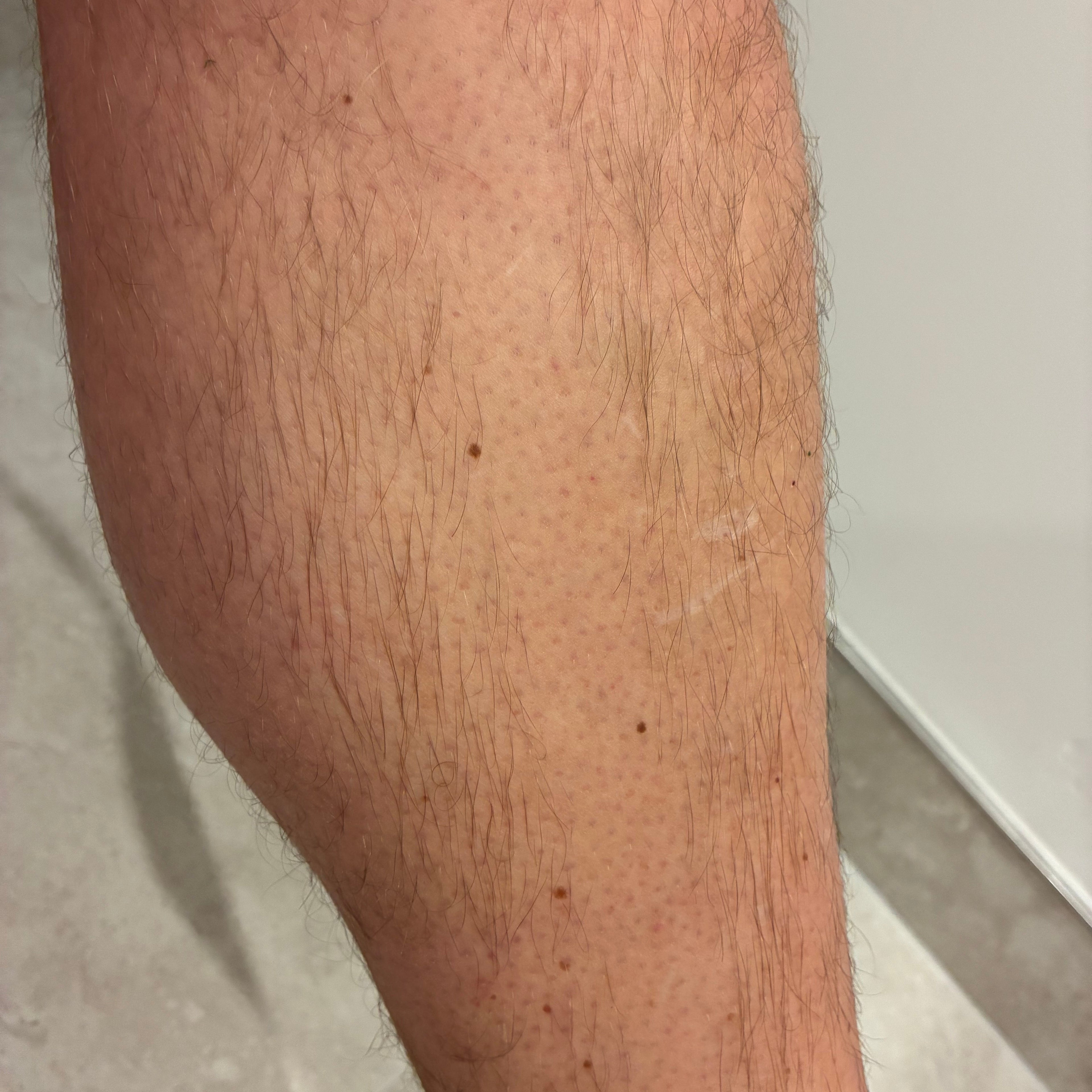 SMOOVE Safety Razor